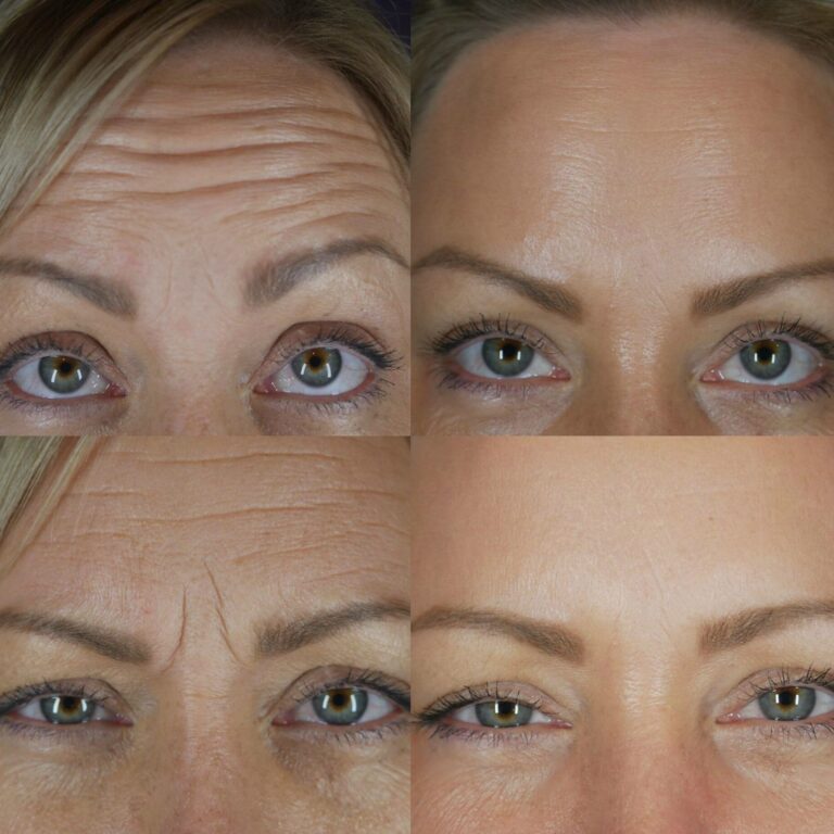 Botox Med Spa Delaware