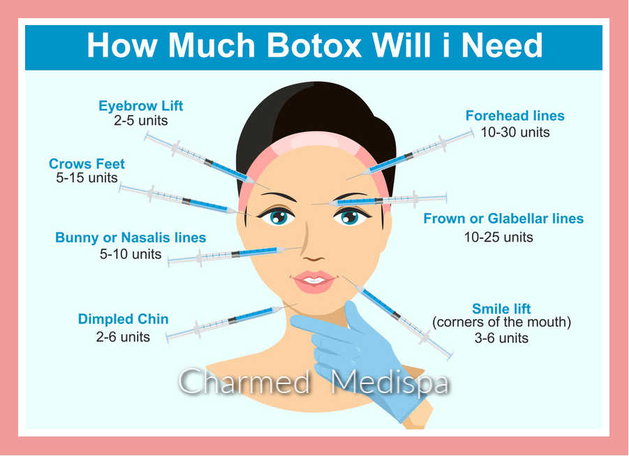 botox-how-much-will-you-need-units-and-dosage-explained-charmed-medispa