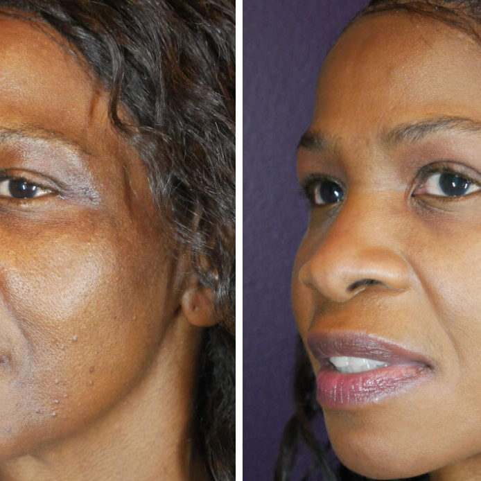 Charmed Medispa ZO Skin Health Results Face