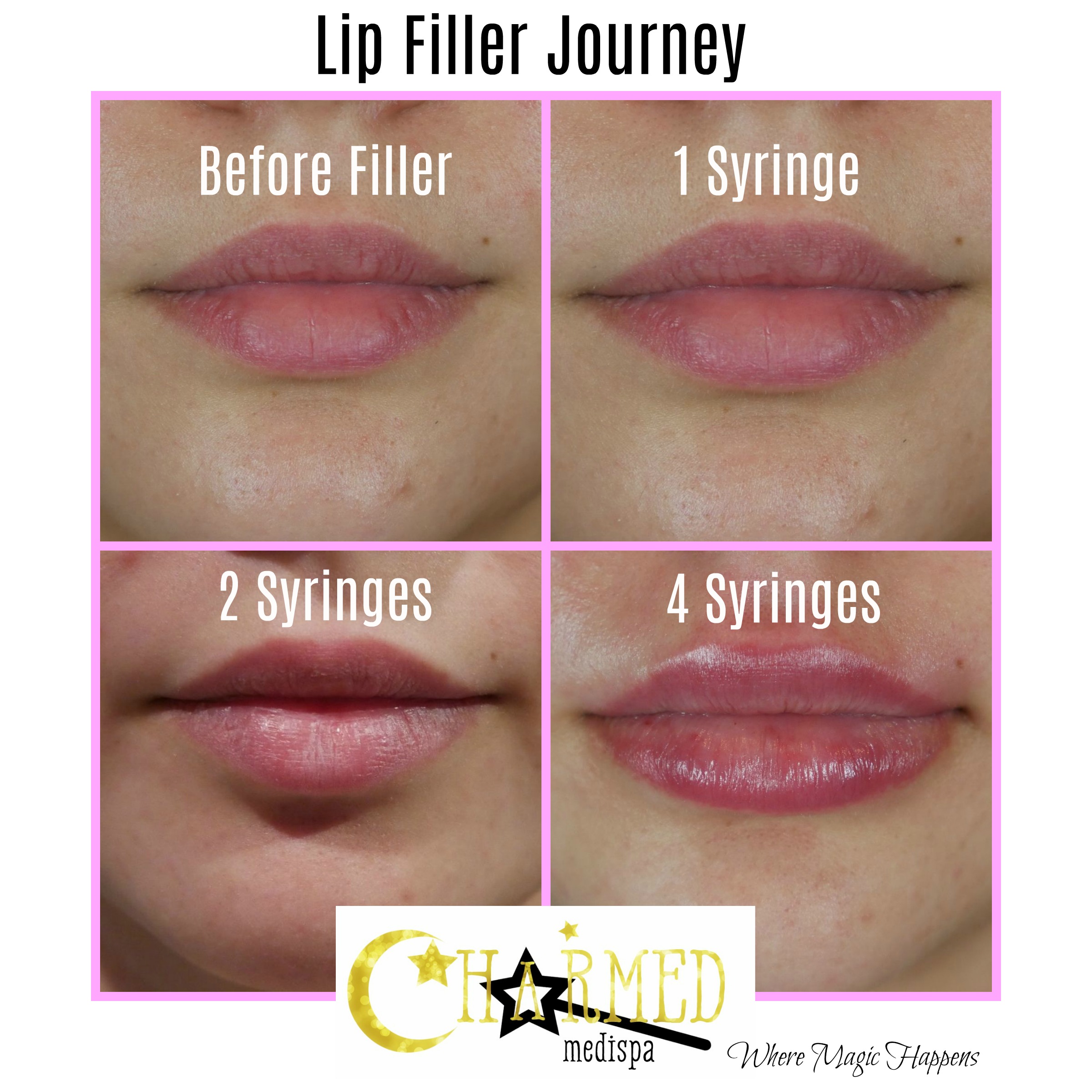 14 June 2018 Charmed Medispa